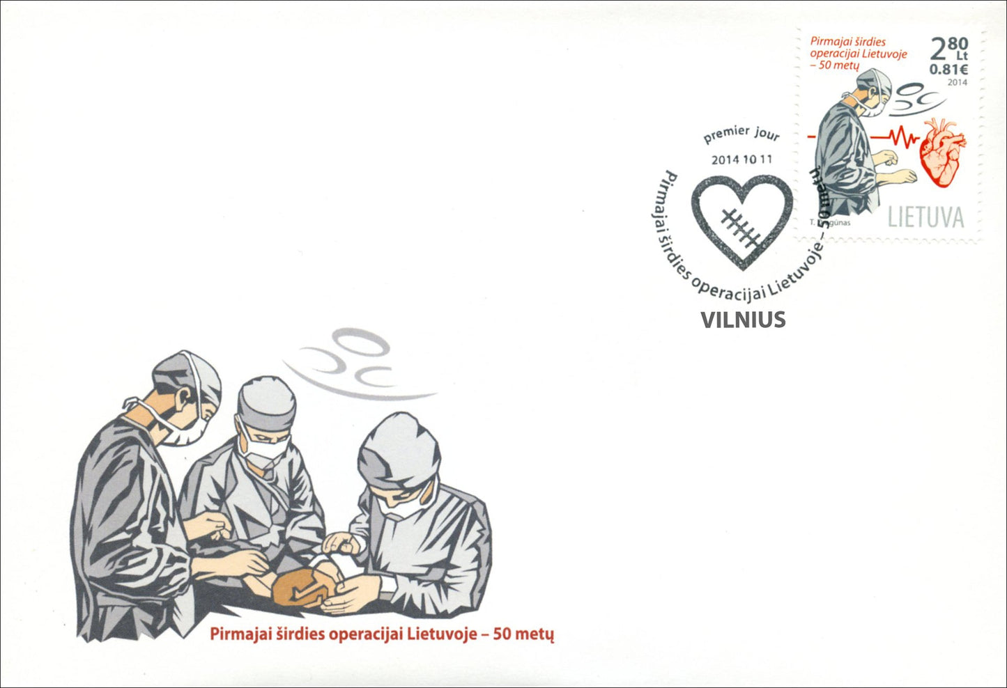 2014 10 11 PDV „PIRMAJAI ŠIRDIES OPERACIJAI LIETUVOJE – 50 METŲ“